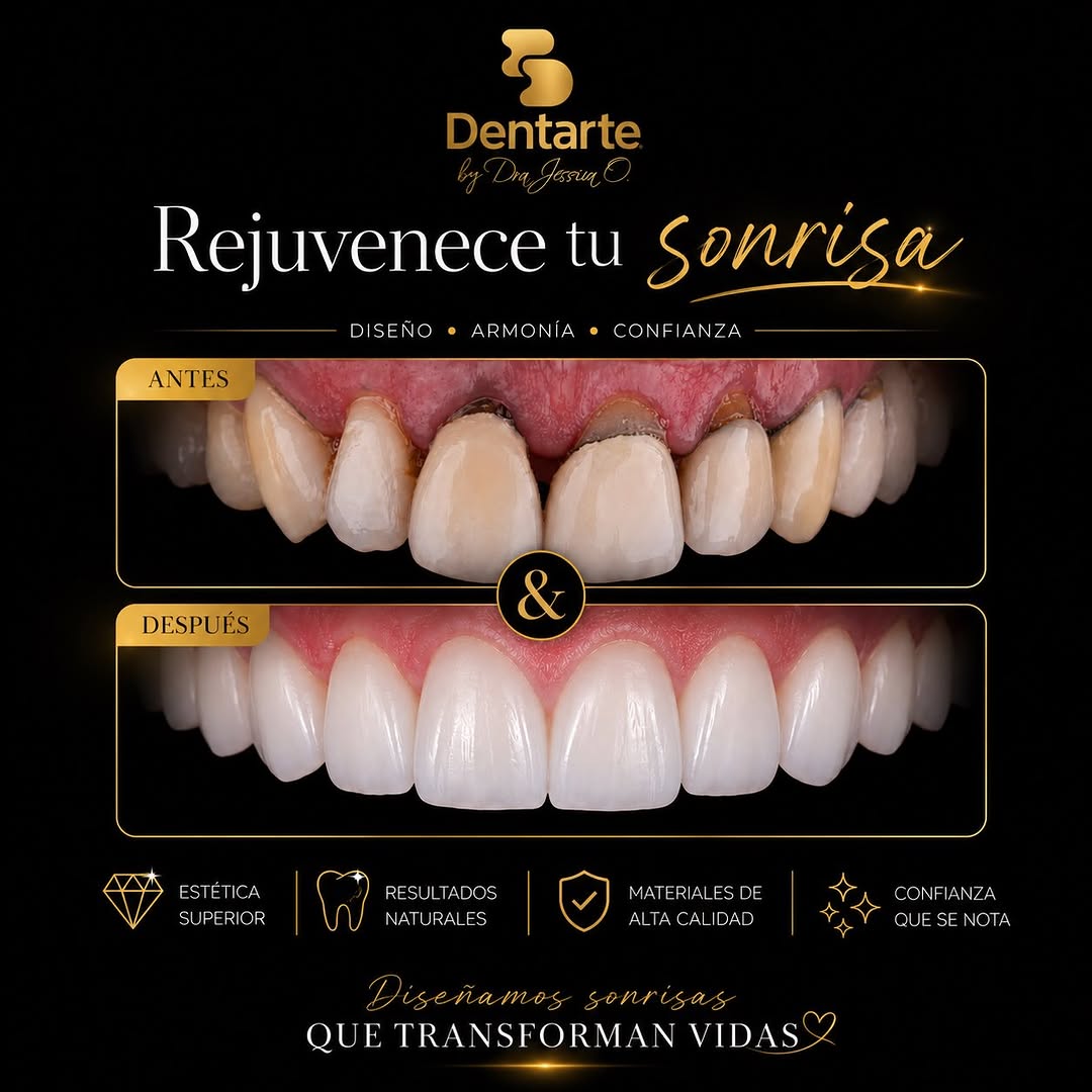 Caso clínico: Rejuvenece tu sonrisa