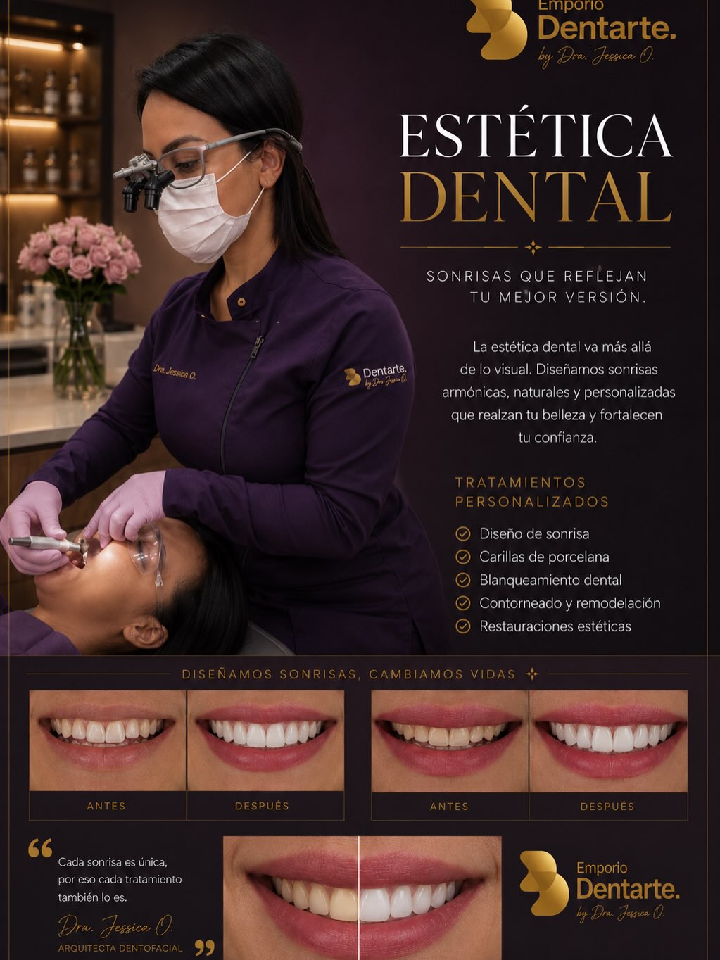 Estética dental