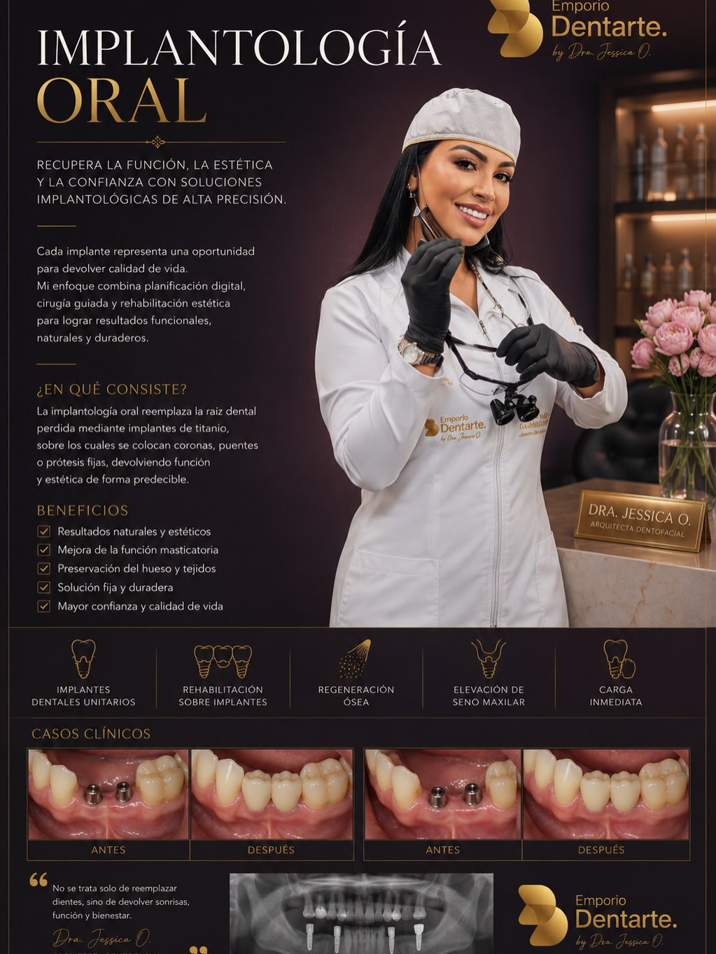Implantología oral